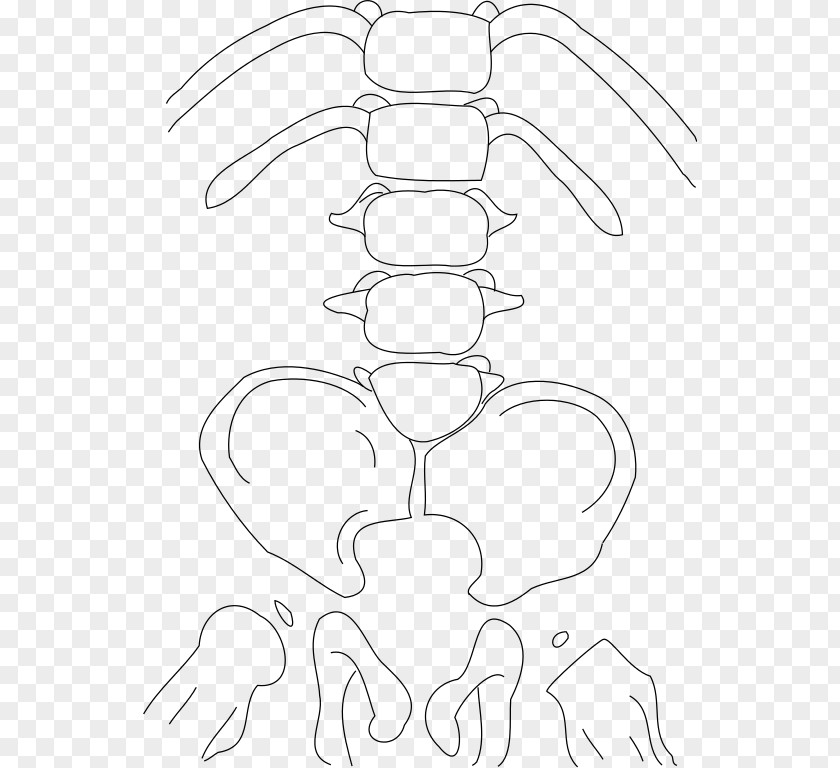 Sacrum Caudal Regression Syndrome Congenital Heart Defect Birth Genetic Disorder PNG