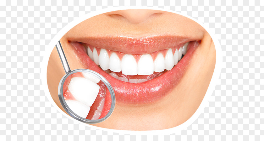 Smile Tooth Whitening Cosmetic Dentistry Human PNG