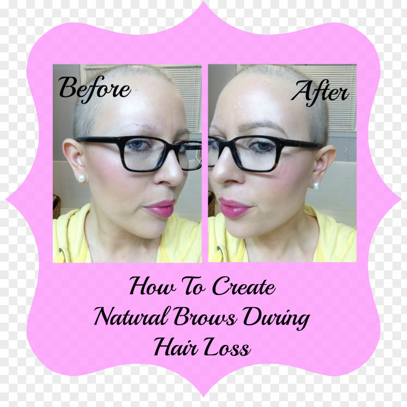 Hair Loss Eyebrow Chemotherapy Nose PNG