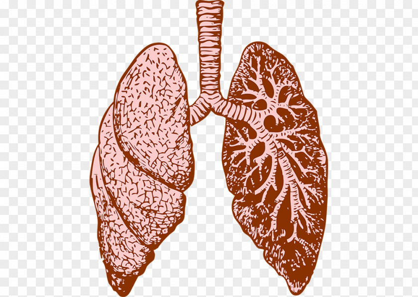 Lung Cystic Fibrosis Idiopathic Pulmonary Therapy PNG