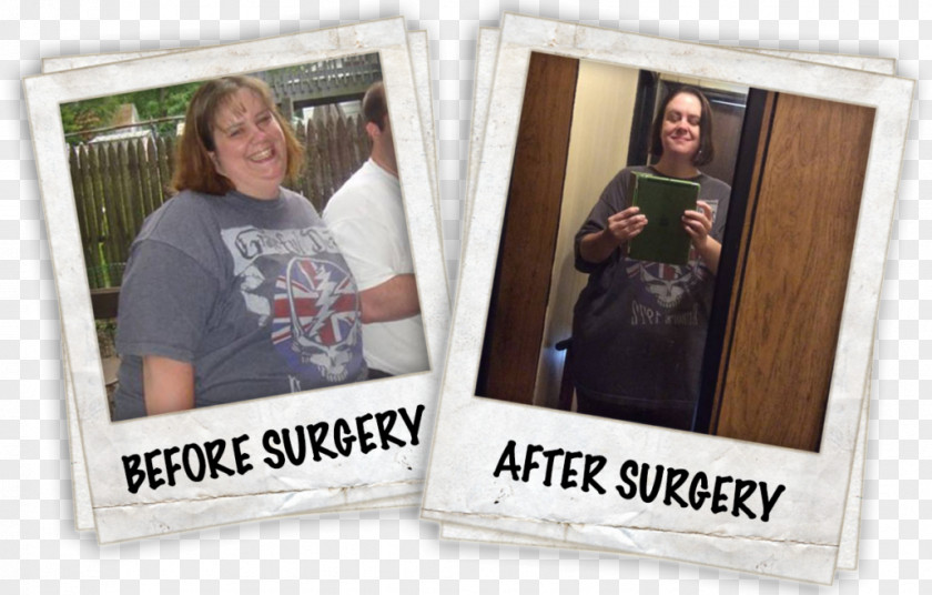 Weight Loss Success Picture Frames PNG
