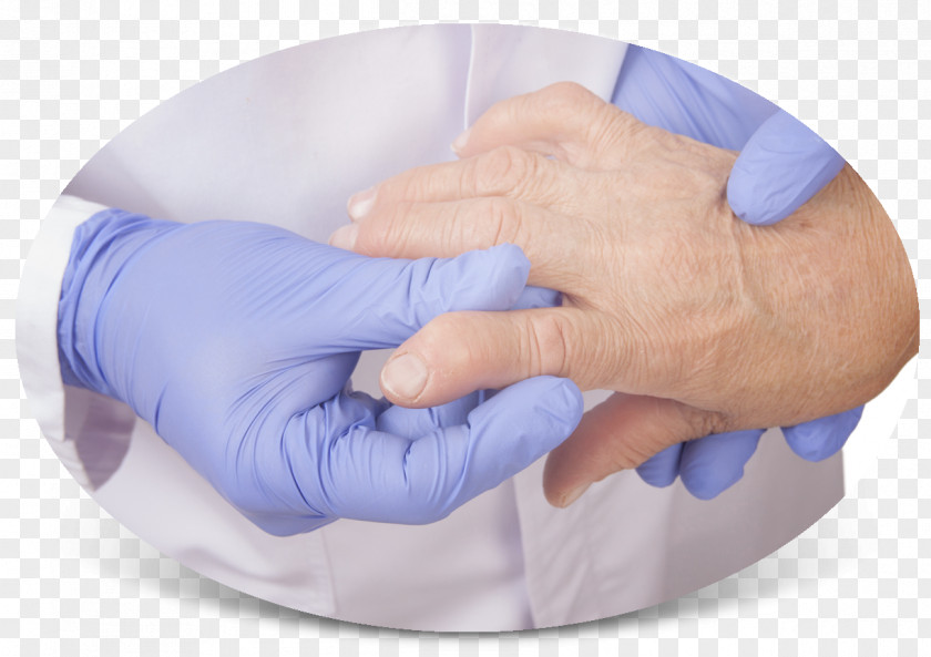 Arthritis Rheumatoid Rheumatology Therapy Disease PNG