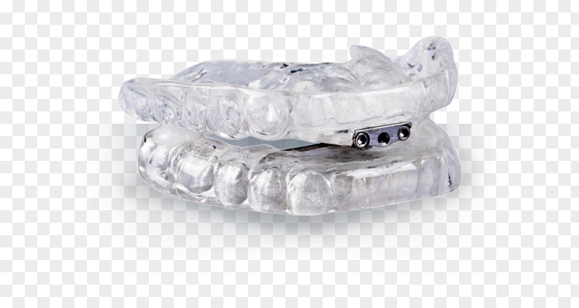 Snoring Mouthguard Mandibular Advancement Splint Dentistry Sleep Apnea PNG