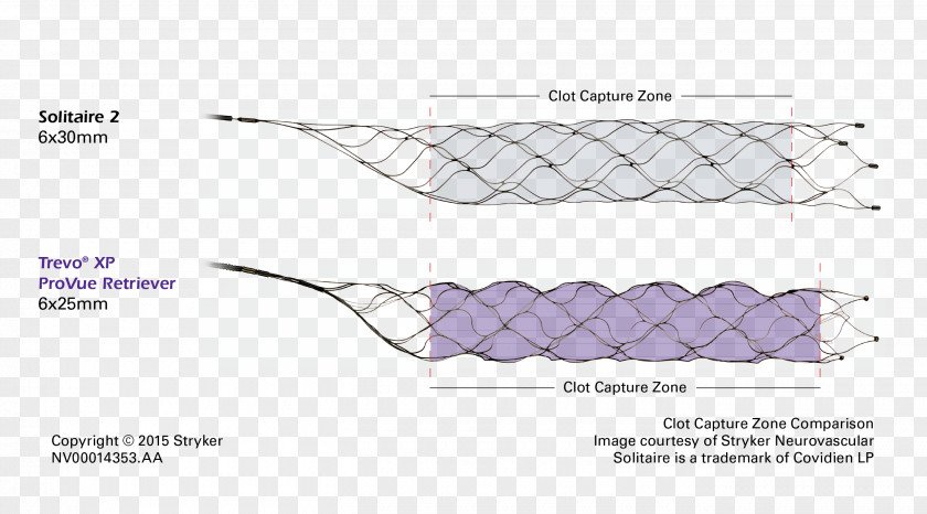 Stryker Corporation Stenting Catheter Patience Thrombus PNG