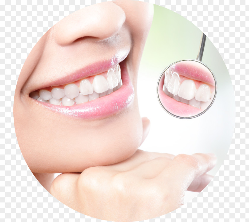 Crown Tooth Whitening Cosmetic Dentistry Human PNG