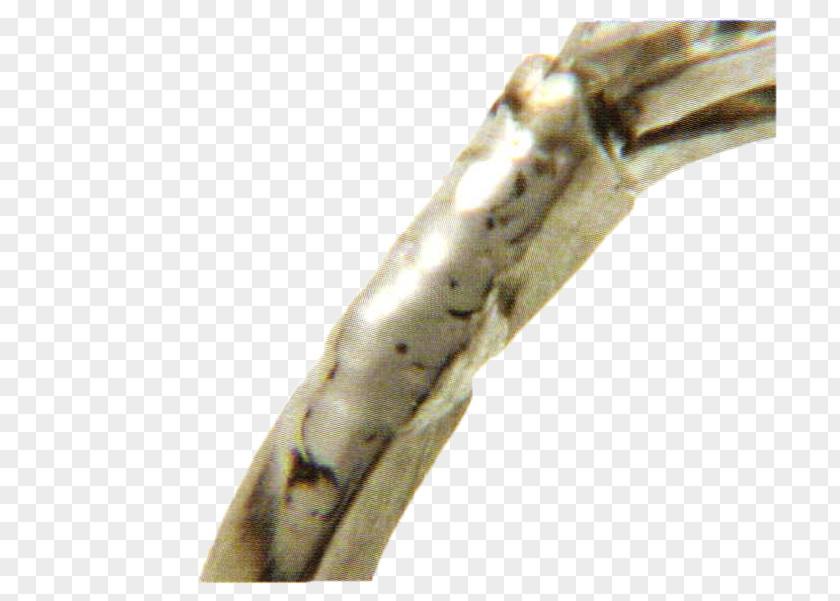 Fig Ring Laser Beam Welding Metal Jewellery Jewelry Design PNG