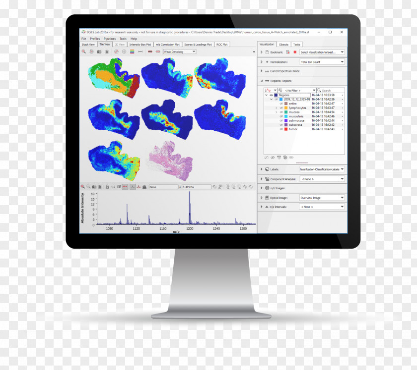 Mass Spectrometry Computer Monitors Display Advertising Organization Font PNG