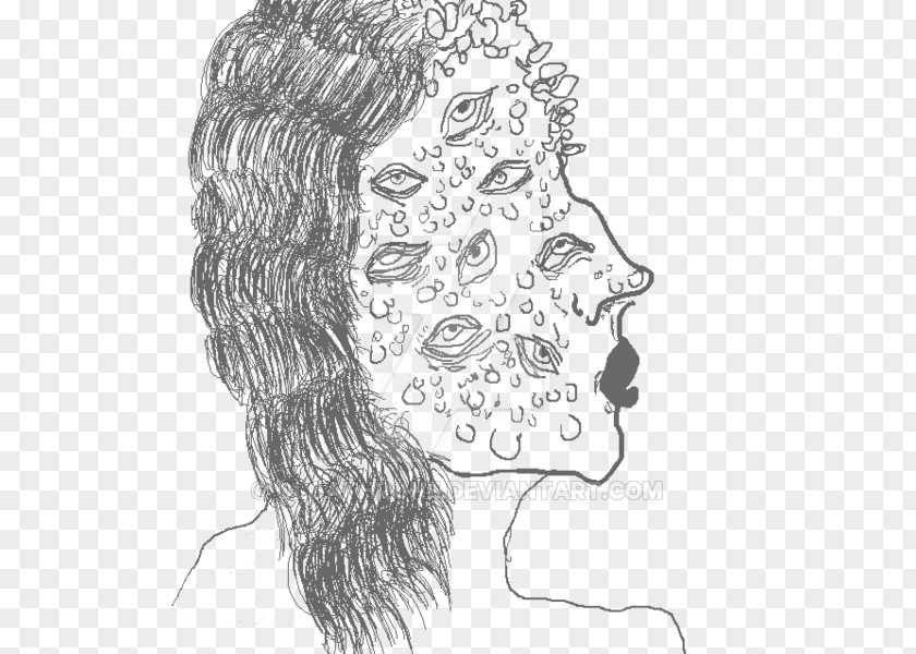 Acne Skin Visual Arts Line Art Sketch PNG