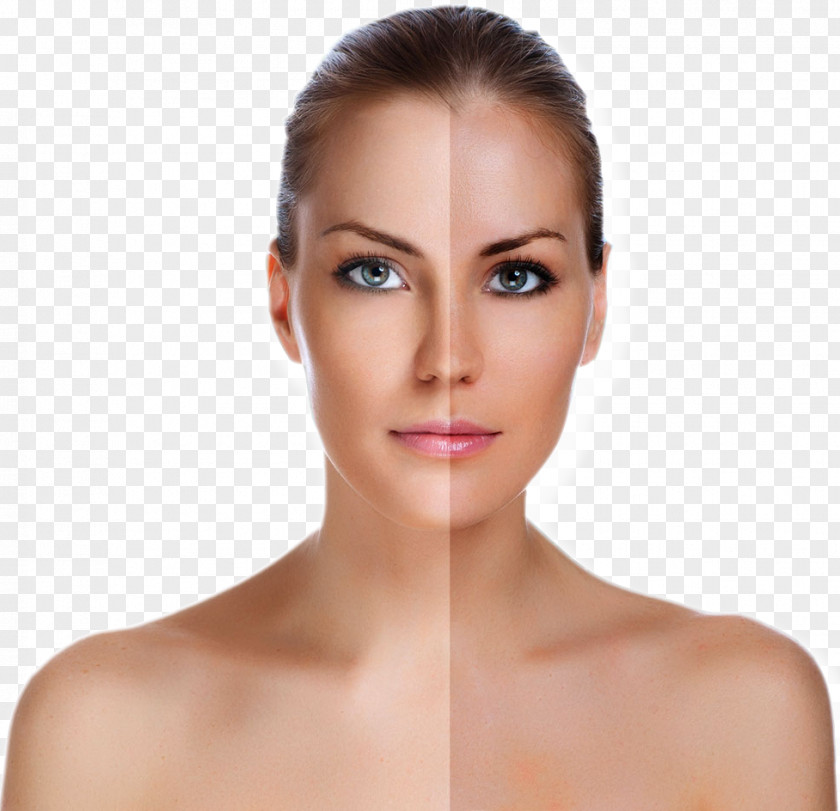 Face Stock Photography Rhytidectomy Skin PNG