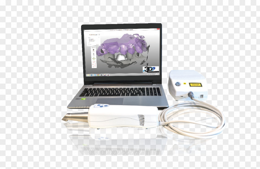 3d Dental Treatment For Toothache Nika Treyd Image Scanner CAD/CAM Dentistry Digital Data PNG