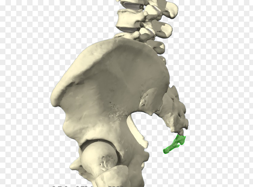 General Knowledge คลินิกกระดูกและข้อ สันป่าข่อยคลินิก Coccyx Coccydynia Bone Vertebral Column PNG