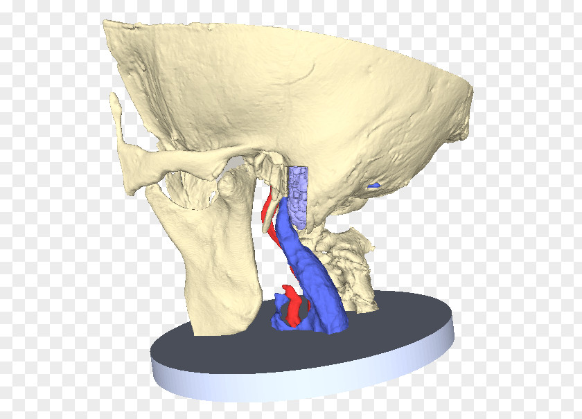 Modelling Prominence Petrous Part Of The Temporal Bone Anatomy Carotid Canal Middle Ear PNG