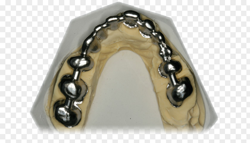 Dental Bridge Metal Body Jewellery PNG