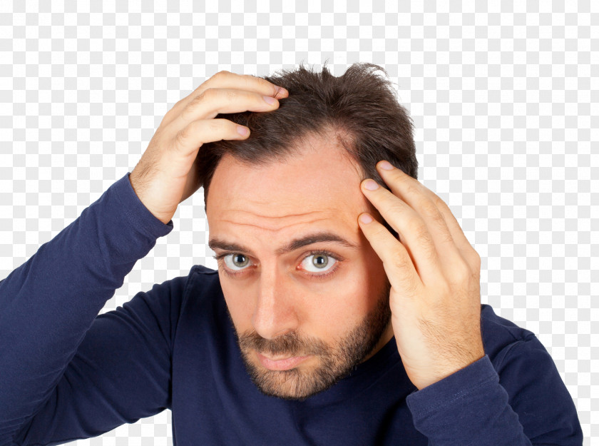 Hair Loss Transplantation Comb Forehead PNG