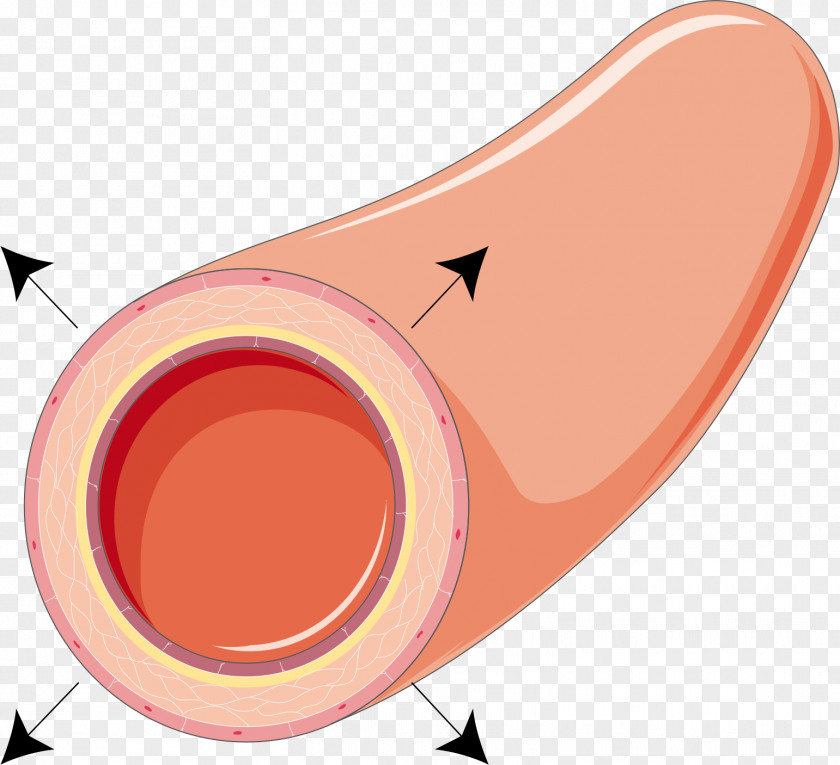 Garlic Blood Pressure Vasodilation Vasoconstriction Physiology Artery Vasospasm PNG