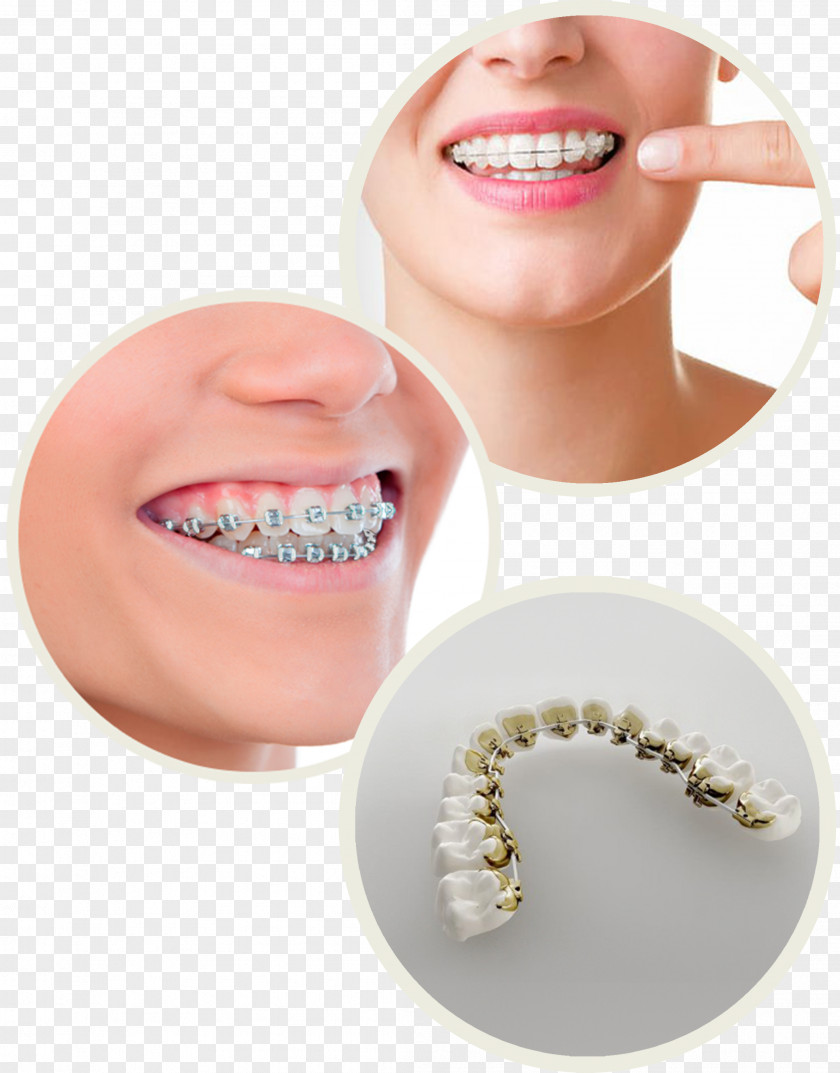 Jaw Tooth Dental Braces Oral Hygiene International Center PNG braces hygiene Center, others clipart PNG