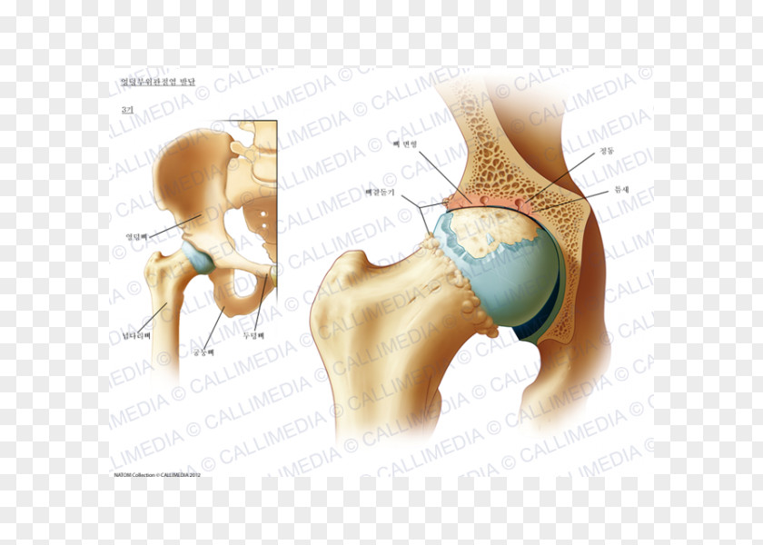 Muscular Development Hip Arthritis Shoulder Rheumatology Coxarthrosis PNG