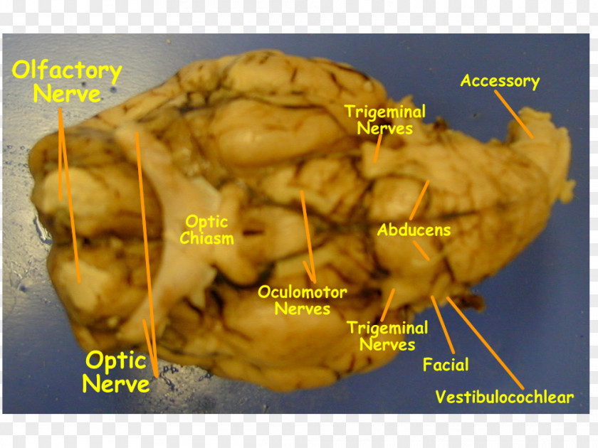 Cranial Nerve Sheep Nerves Brain Hypoglossal Olfactory PNG