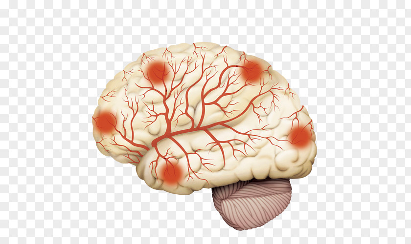 Hand-painted Brain Meridian Map Disease Arteriosclerosis Cerebrum Intracranial Aneurysm PNG