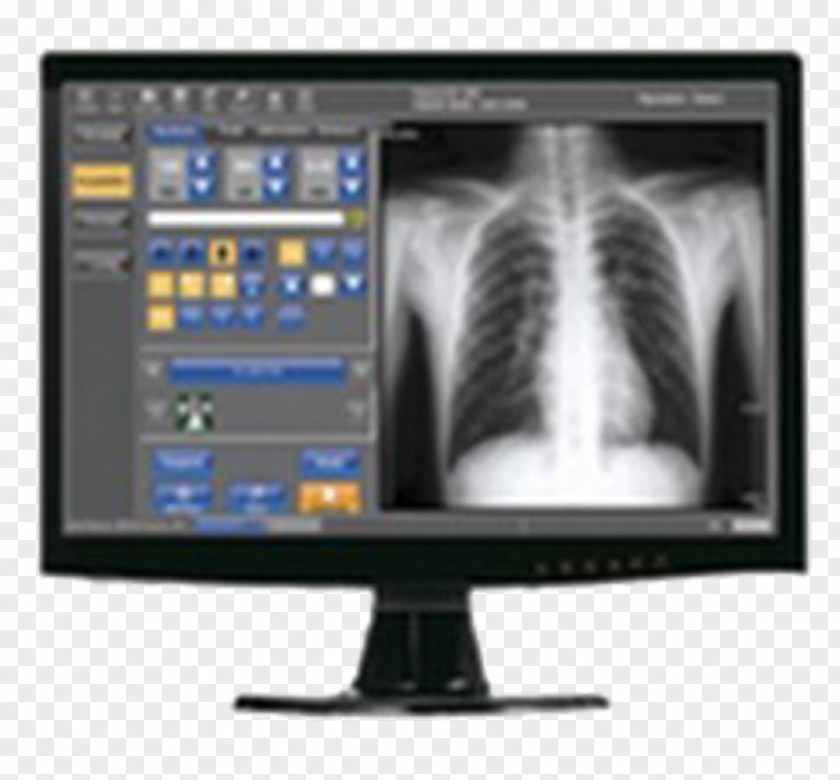 Rayos X X-ray Digital Data Image Light Radiography PNG