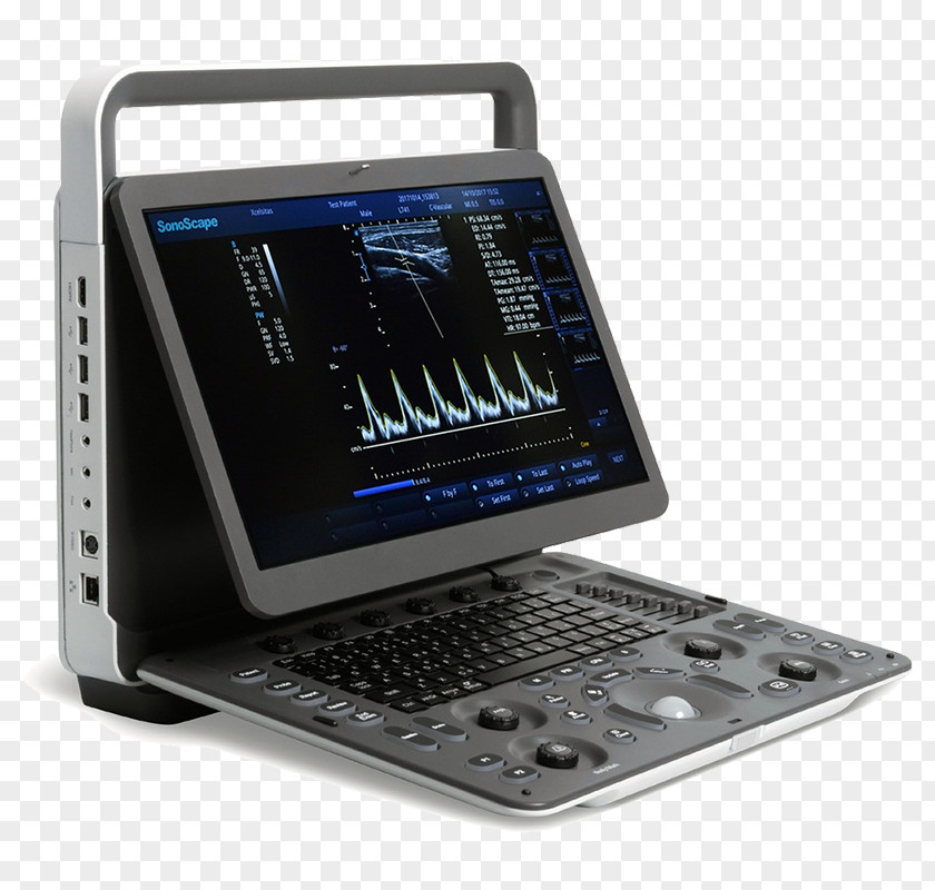 Ti83 Series Ultrasonography Portable Ultrasound SonoScape Medical Corp Imaging PNG