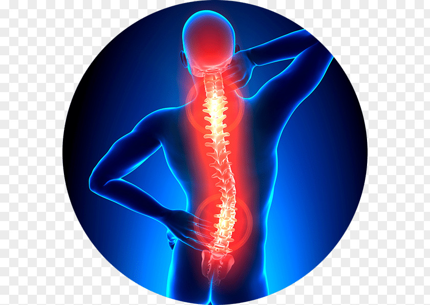 Health Vertebral Column Back Pain Neck Physical Therapy Spinal Stenosis PNG