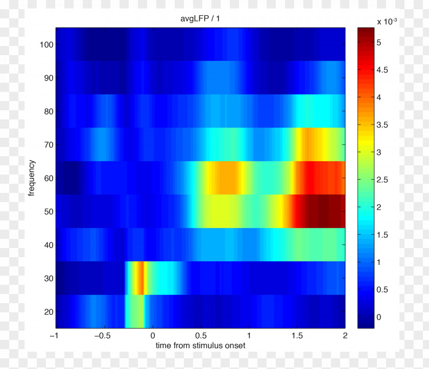 Data Preprocessing MATLAB Local Field Potential Phase Spectrogram Time–frequency Representation PNG