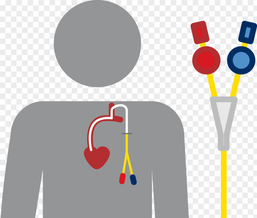 Fistula Central Venous Catheter Cateter Vascular Infection PNG