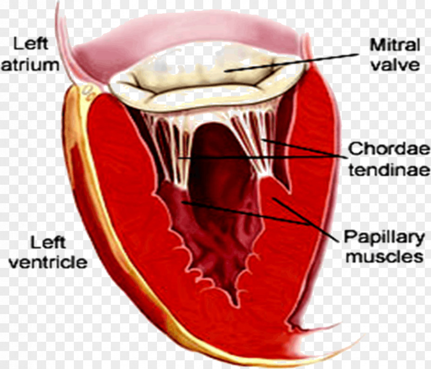 Heart Mitral Valve Stenosis Insufficiency PNG