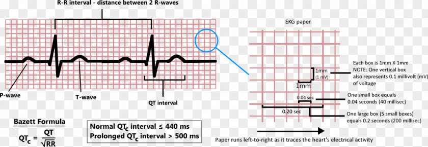 QT Interval Diagram Point Health Care Angle PNG