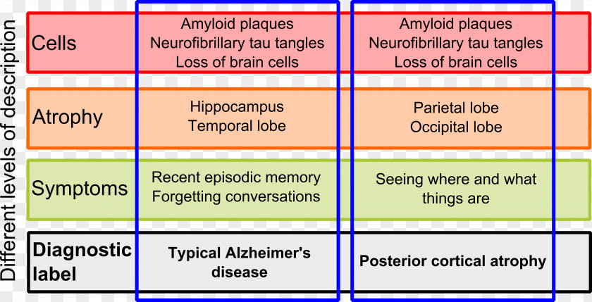Brain Cerebral Atrophy Dementia Symptom PNG