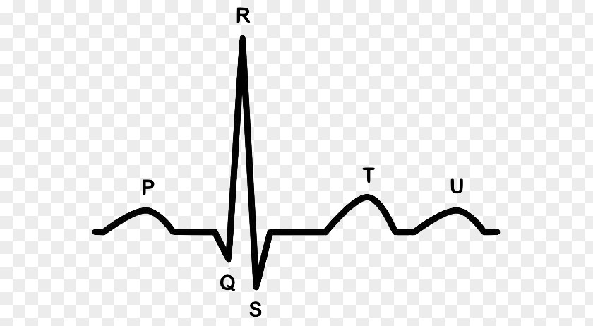 Heart Electrocardiography Arrhythmia Cardiology Cardiovascular Disease PNG