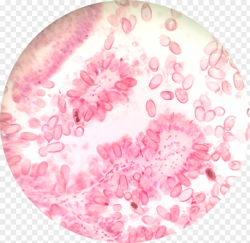 Liver Protist Cyclospora Cayetanensis Adibide Wikipedia Protozoa PNG