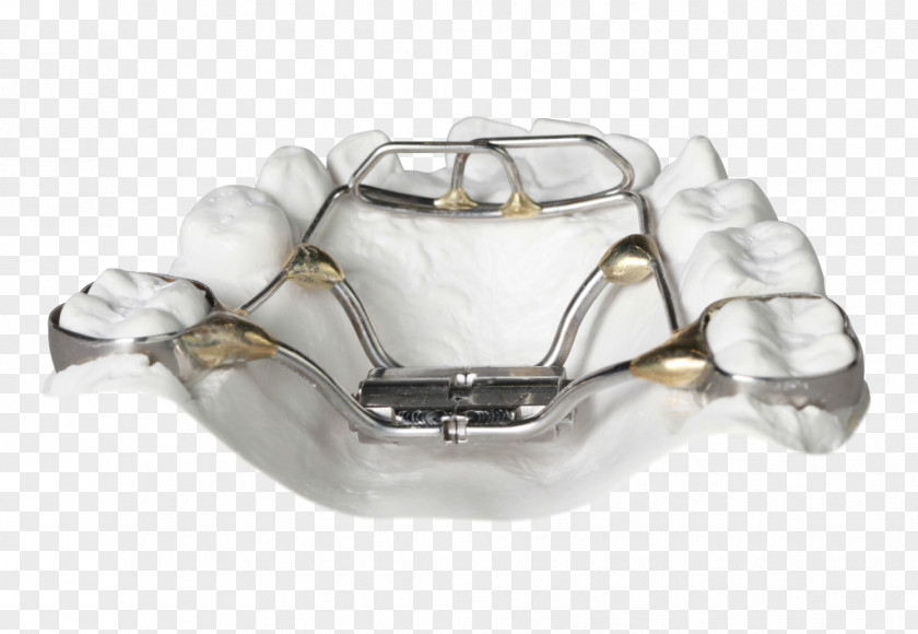 Tongue Orthodontics Palatal Expansion Cots Retainer PNG