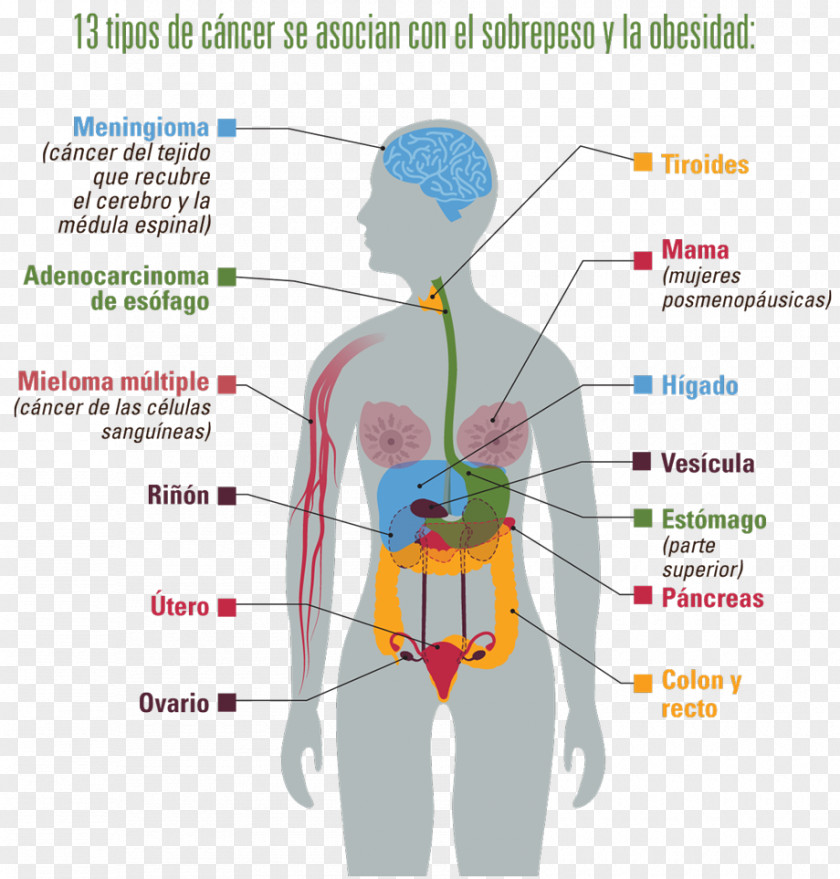 Pancreas Centers For Disease Control And Prevention Obesity Cancer Overweight PNG