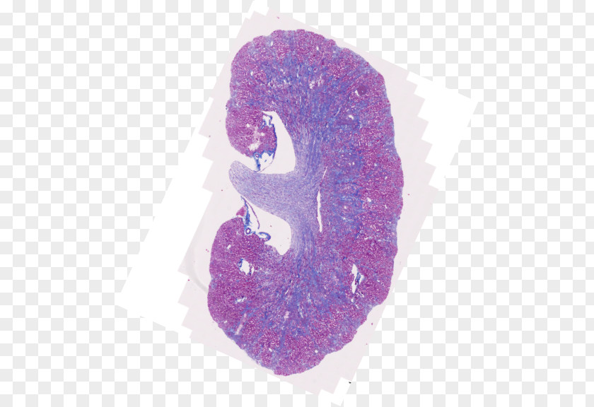 Kidney Lilac Lavender Violet Magenta Purple PNG