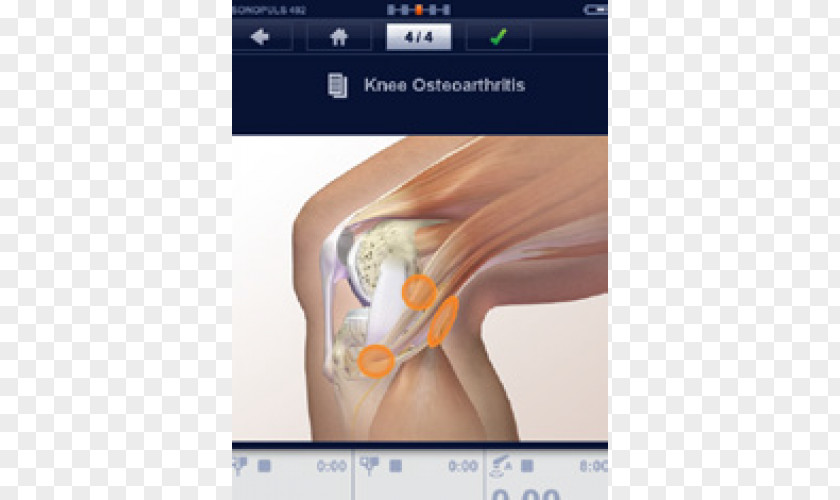 Physical Therapy Therapeutic Ultrasound Electrotherapy Combination PNG