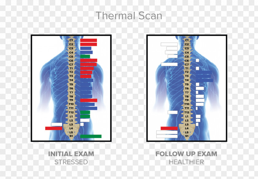 Thermal McKillican Chiropractic Chiropractor Nervous System Technology PNG