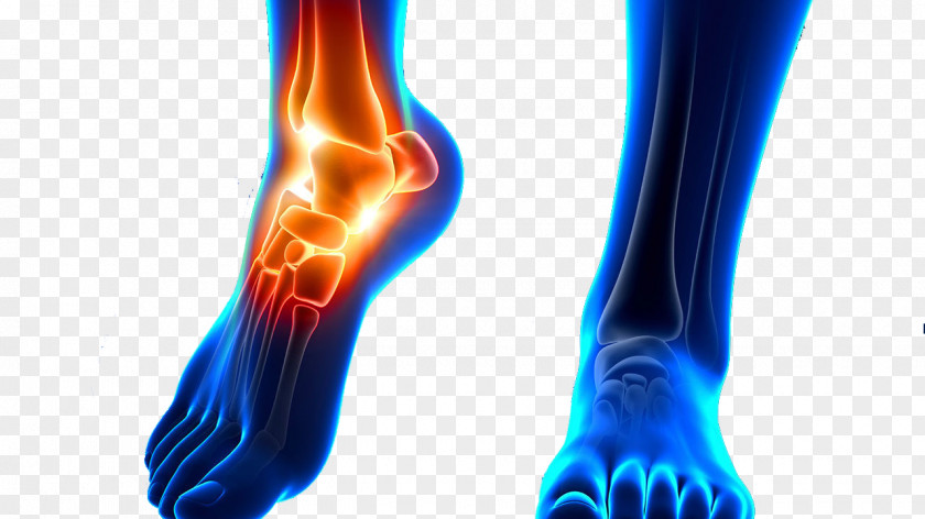 Physiotherapy Ankle Sprain Joint Physical Therapy Foot PNG