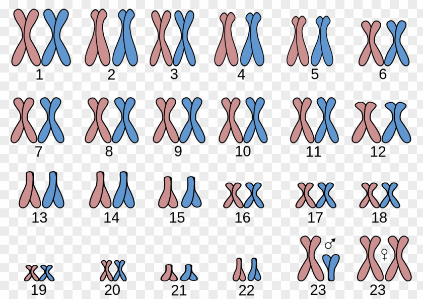 Angel Man Karyotype Chromosome 21 Turner Syndrome Abnormality PNG