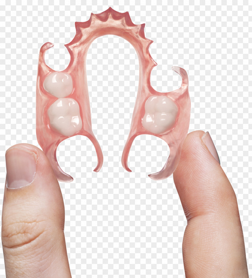 Dental Laboratory Dentures Dentistry Removable Partial Denture PNG