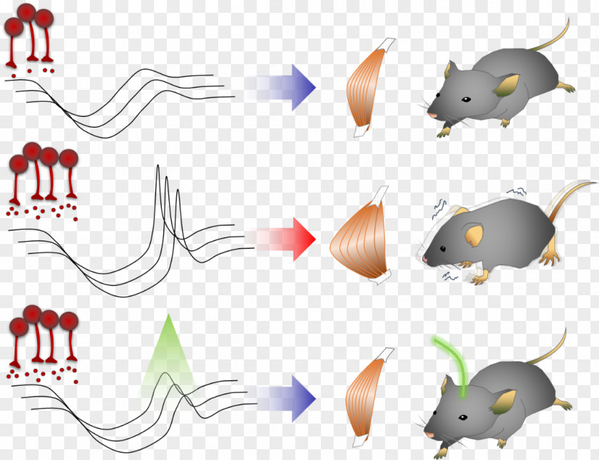 Basal Parkinson's Disease Ganglia KAIST Dystonia PNG