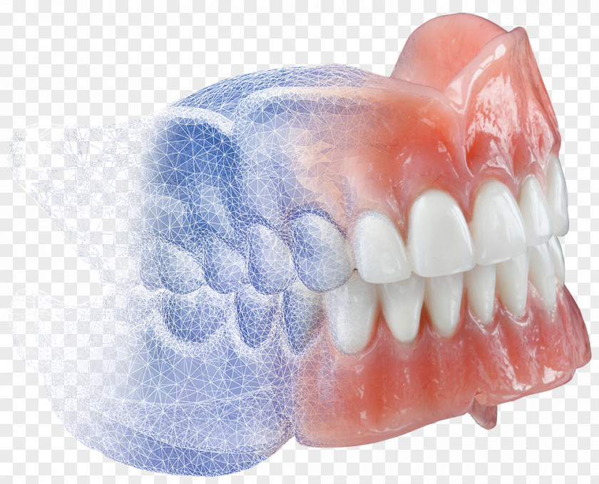 3d Dental Treatment For Toothache Dentures Burdette Lab CAD/CAM Dentistry PNG