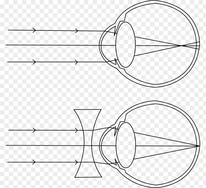 Light Near-sightedness Visual Perception Eye Lens PNG