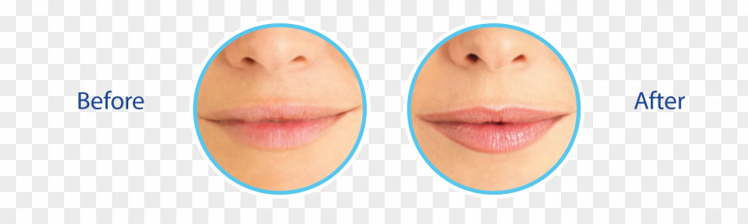 Nail Thumb Lip Chin Cheek Mouth PNG