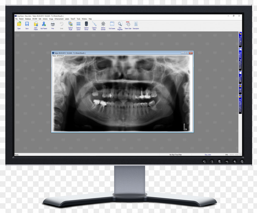 X-ray Vision Dental Radiography Dentistry PNG