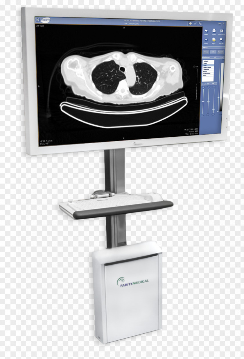 Medicine Picture Archiving And Communication System Radiology Display Device McKesson Corporation PNG