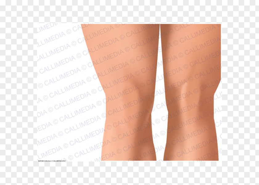 Thigh Knee Human Anatomy Skin PNG anatomy Skin, arm clipart PNG
