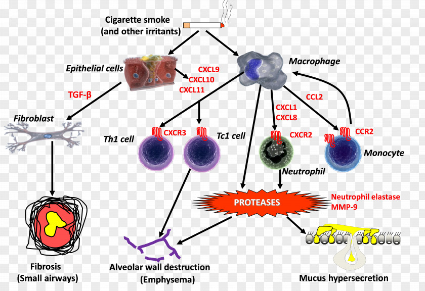 Acute Exacerbation Of Chronic Obstructive Pulmonary Disease Inflammation Eosinophil PNG