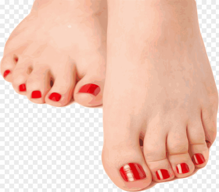 Sore Foot Hammer Toe Nail Onychomycosis PNG